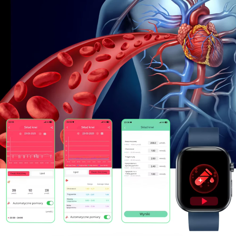 Kardiowatch CardioNyx – idealny do monitorowania zdrowia.