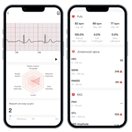 Kardiowatch Volt – ekran na aplikacji Gband