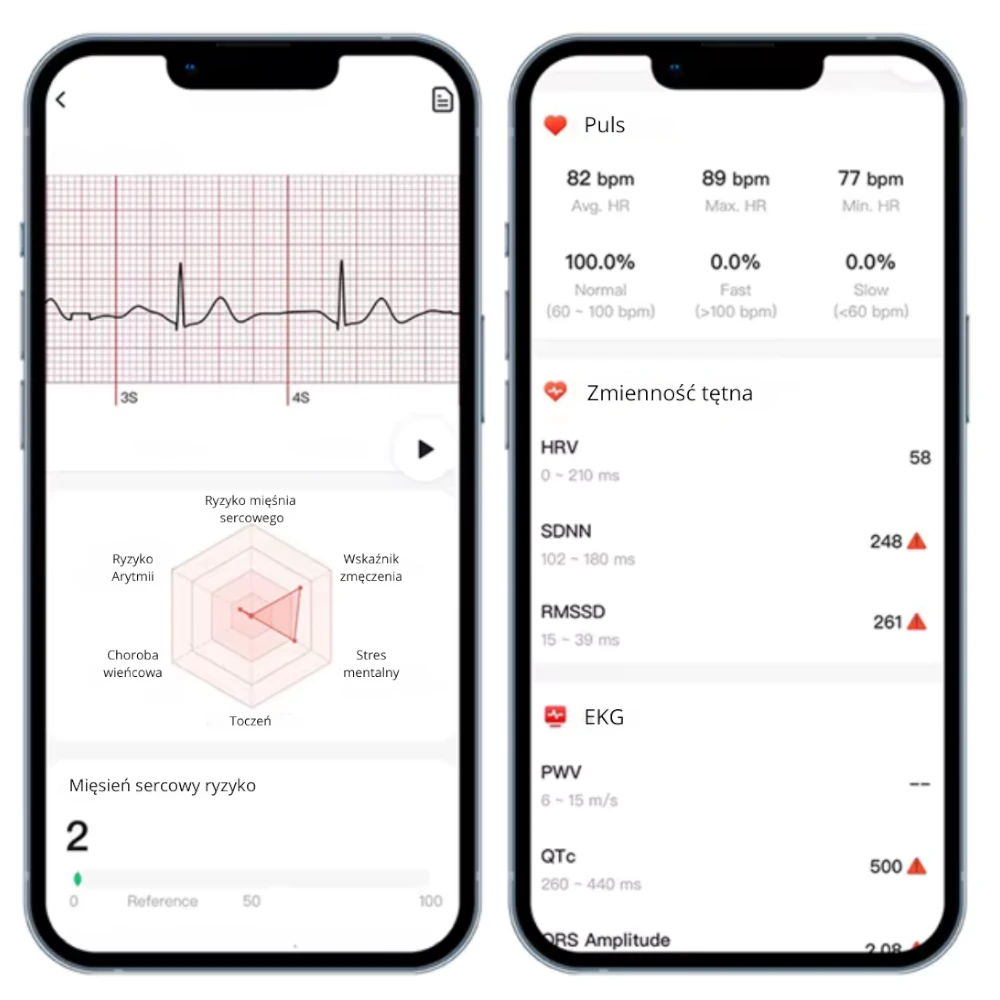 Kardiowatch Volt – ekran na aplikacji Gband